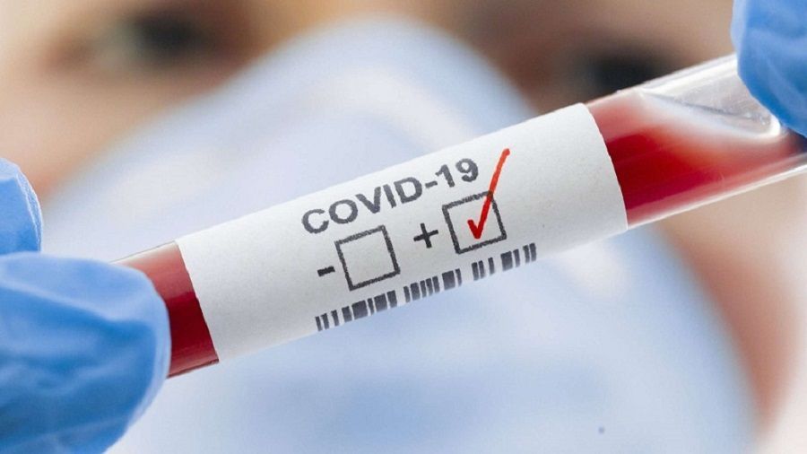 Юношеское первенство Дальнего Востока отменили из-за положительных тестов на COVID-19