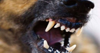 В Якутии ребенок, пострадавший от укусов бродячей собаки, получит компенсацию